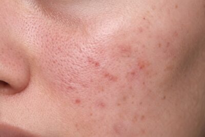 TEST Moisture Maskuojantis Daugiafunkcinis CC Kremas – PATOBULINTAS Moisture.lt 66